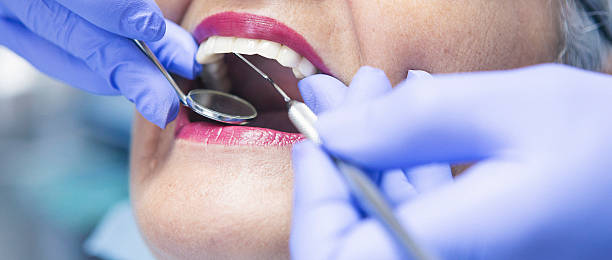 Best Emergency Dental Care for Broken or Chipped Teeth in Grants, NM